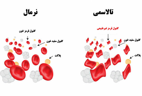 تالاسمی